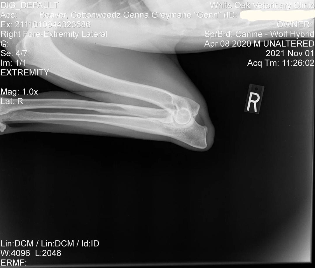 Genn Preliminary Right Elbow X-Ray